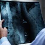 Nowoczesne rozwiązania diagnostyki obrazowej w Gorlicach